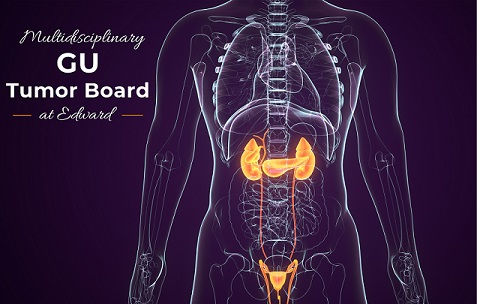 2022 EDW Multidisciplinary GU Tumor Board (RSS) Banner
